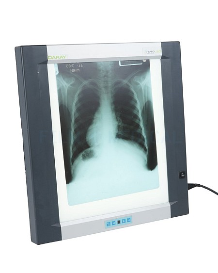  X-Ray Light Box Viewer